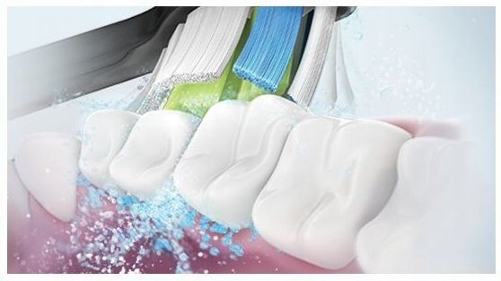Електрична зубна щітка Philips Sonicare ProtectiveClean 5100 чорний 882436 фото